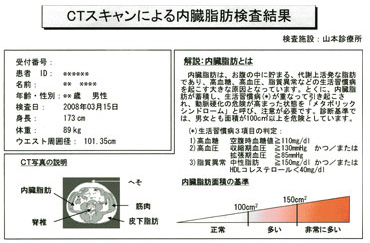 メタボリック検査の画像01